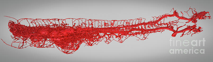 Mojave Rattlesnake Photograph - Rattlesnake Blood Vessels by Scott Birch/pixelbeaker/science Photo Library Mojave Rattlesnake Photograph - Rattlesnake Blood Vessels by Scott Birch/pixelbeaker/science Photo Library