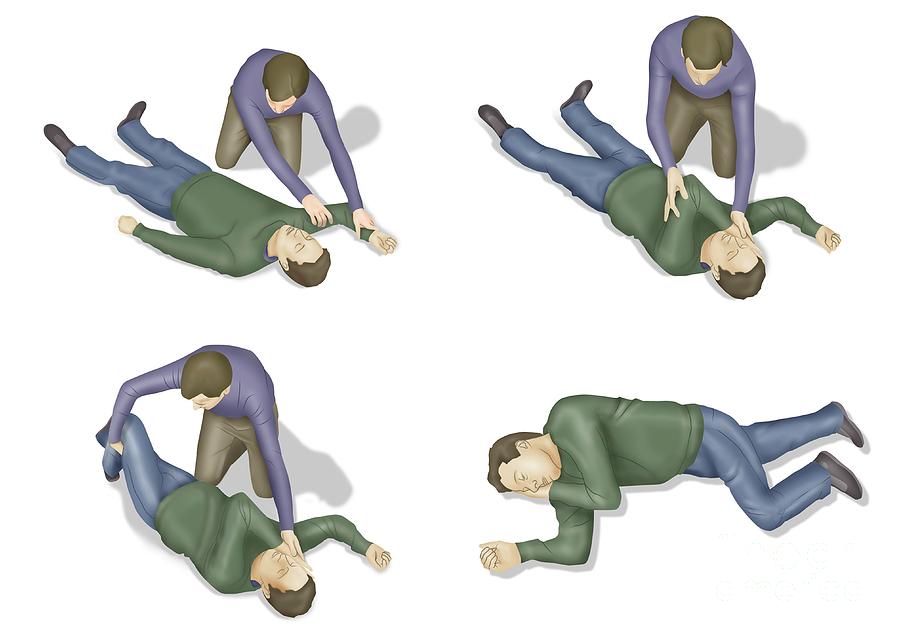 How Does The Recovery Position Work First Aid For Fre - vrogue.co