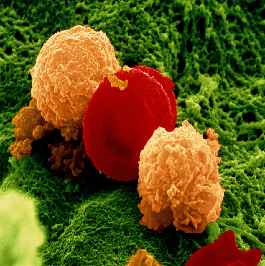 Red And White Blood Cells Photograph by Meckes/ottawa
