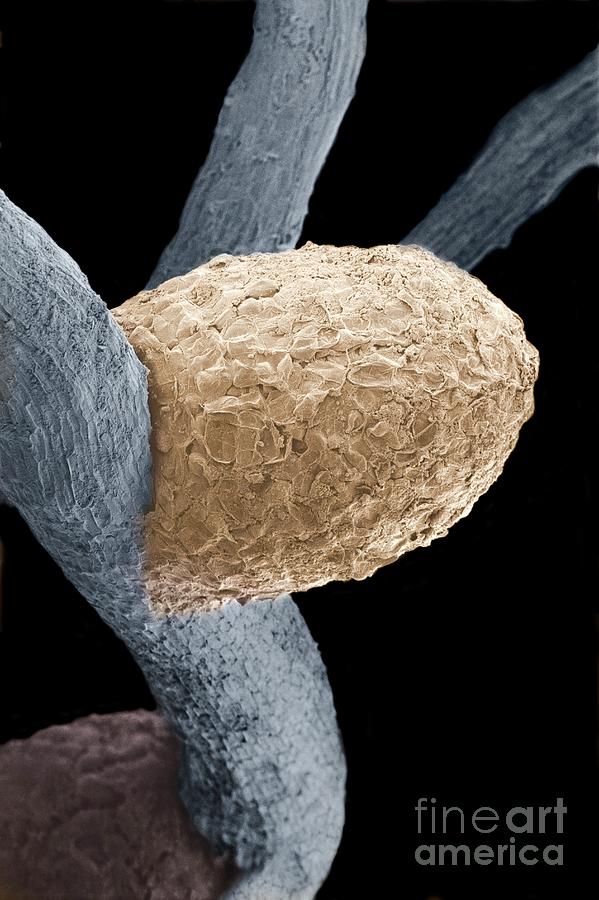 Rhizobium Nodules On A Clover Root Photograph by Dr Jeremy Burgess/science Photo Library