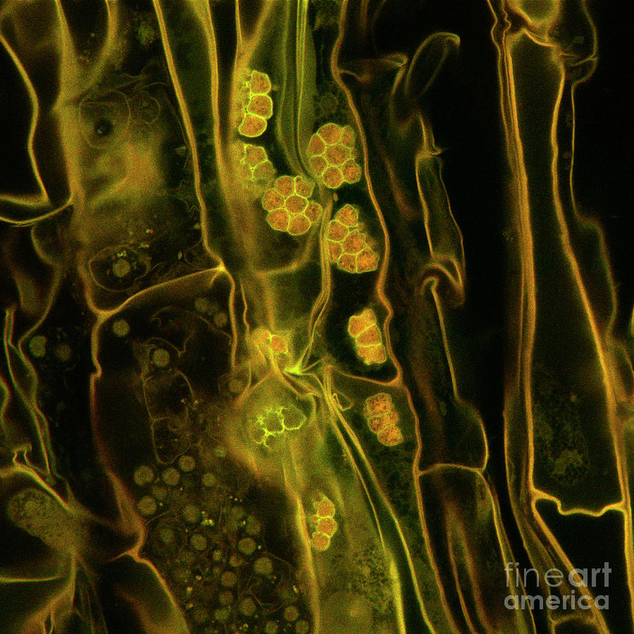 Rice Root Fungus by Stefanie Reichelt/science Photo Library