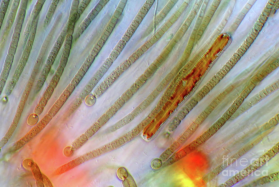 Rivularia Cyanobacteria And Diatom by Marek Mis/science Photo Library