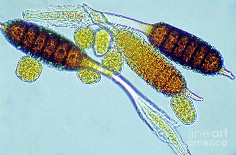 Rose Spot Fungus Spores Photograph by Dr Keith Wheeler/science Photo Library
