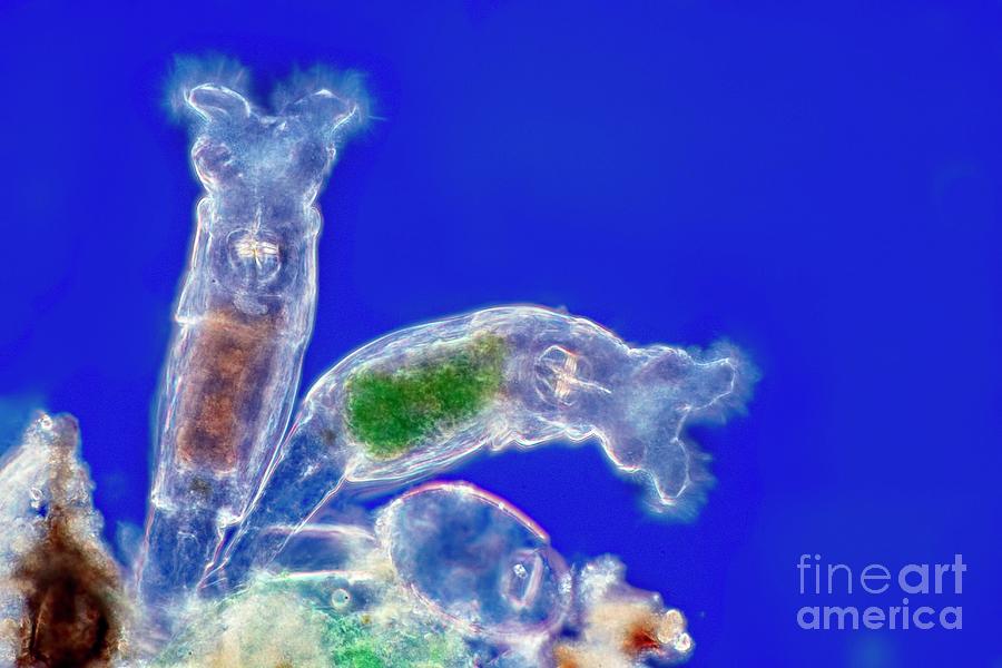 Rotifer Colony by Frank Fox/science Photo Library