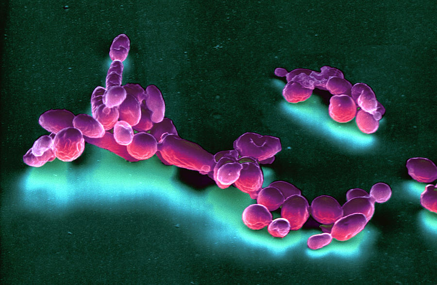 Saccharomyces Ellipsoideus Photograph by Meckes/ottawa
