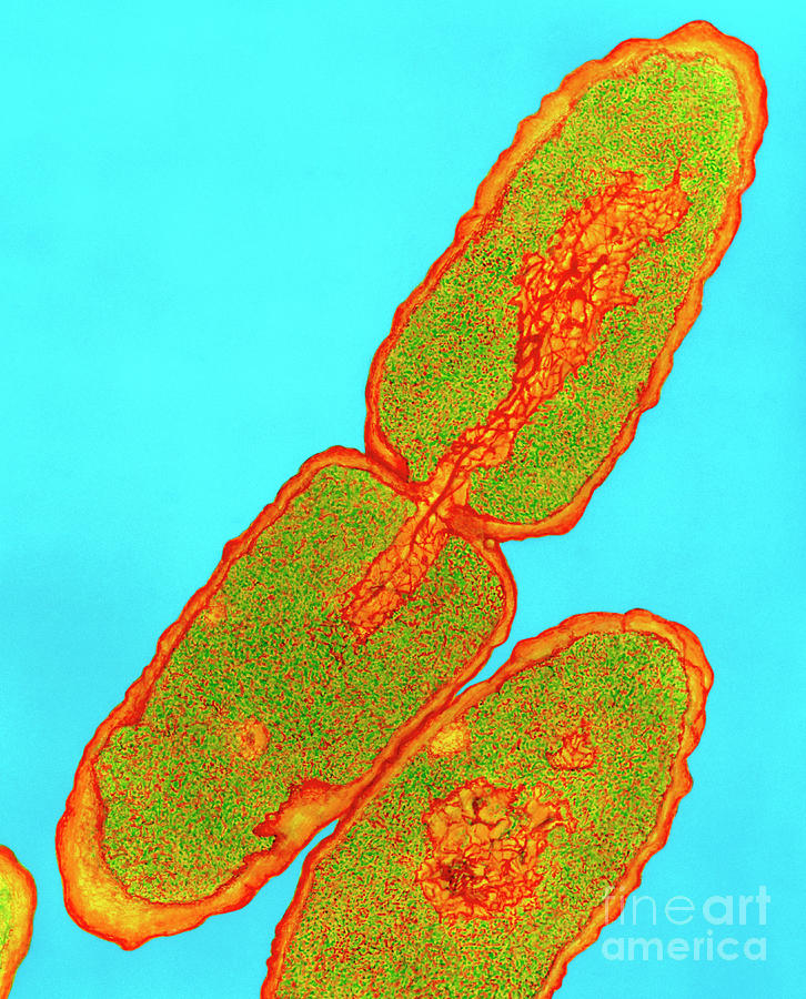 Salmonella Typhimurium Bacteria Photograph By Dr Kari Lounatmaa Science Photo Library Fine Art