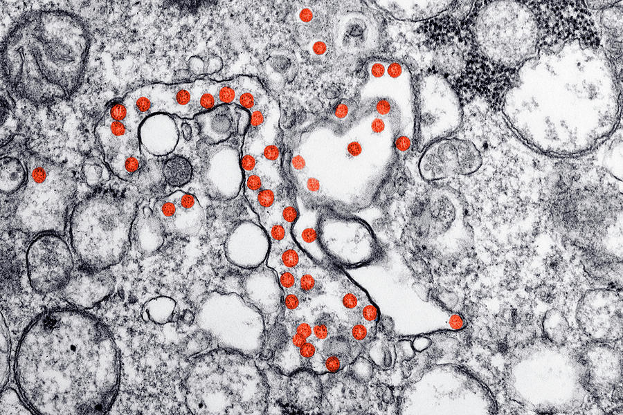 Sars-cov-2, Covid-19 Virus, Tem Photograph by Science Source