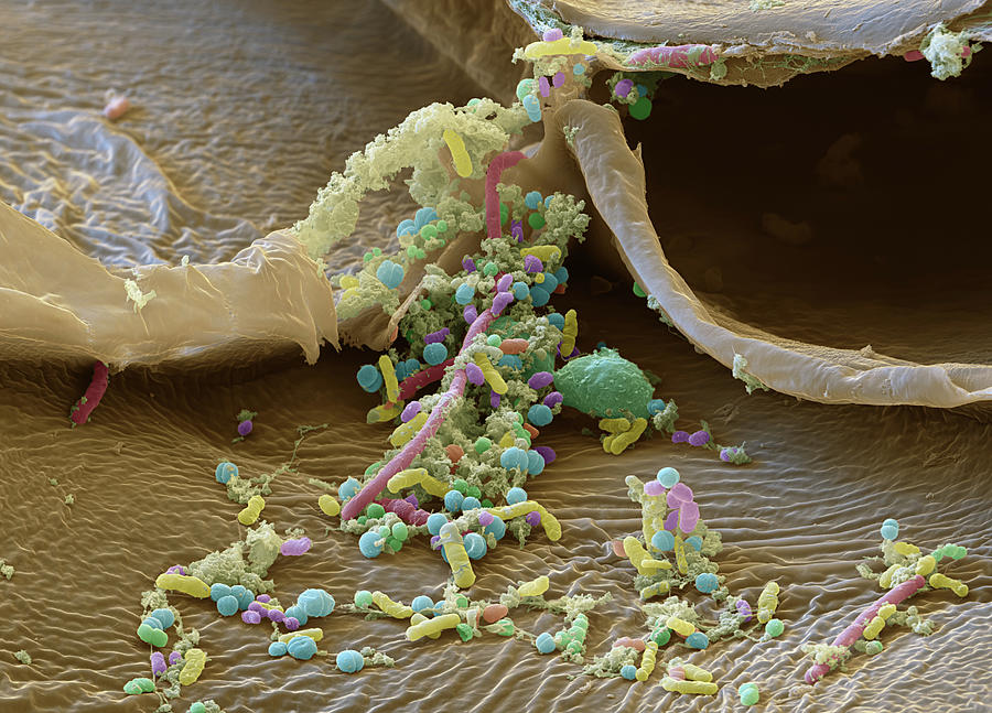 Sauerkraut, Sem Photograph by Oliver Meckes EYE OF SCIENCE