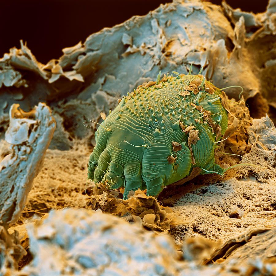 Scabies Mite, Sem Photograph by Meckes/ottawa