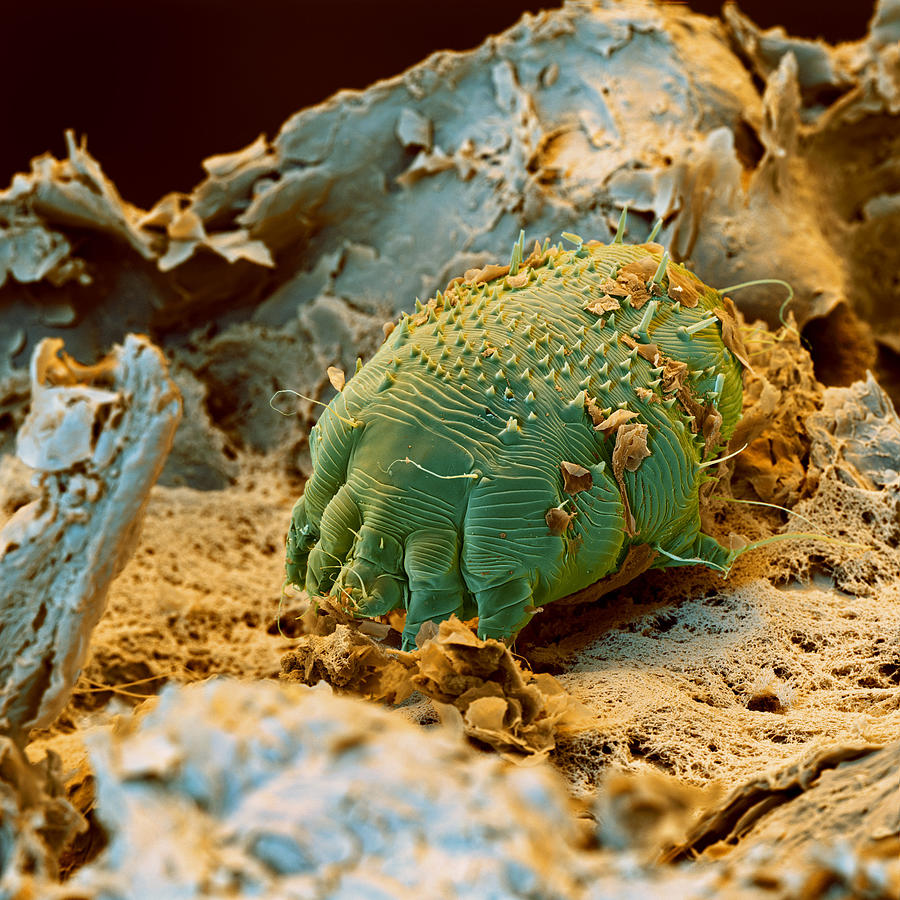 Scabies Mites Photograph by Oliver Meckes EYE OF SCIENCE