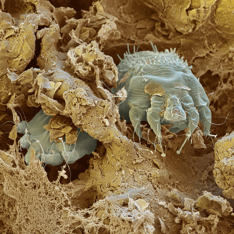 Scabies Mites, Sem Photograph by Oliver Meckes EYE OF SCIENCE