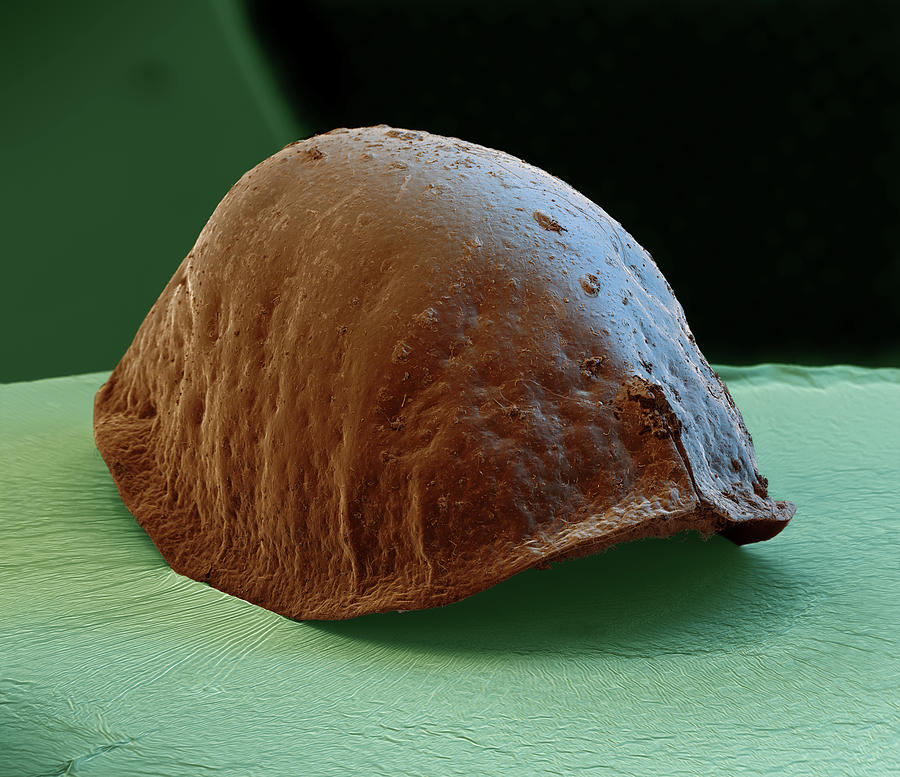 Scale Insect, Sem Photograph by Eye Of Science