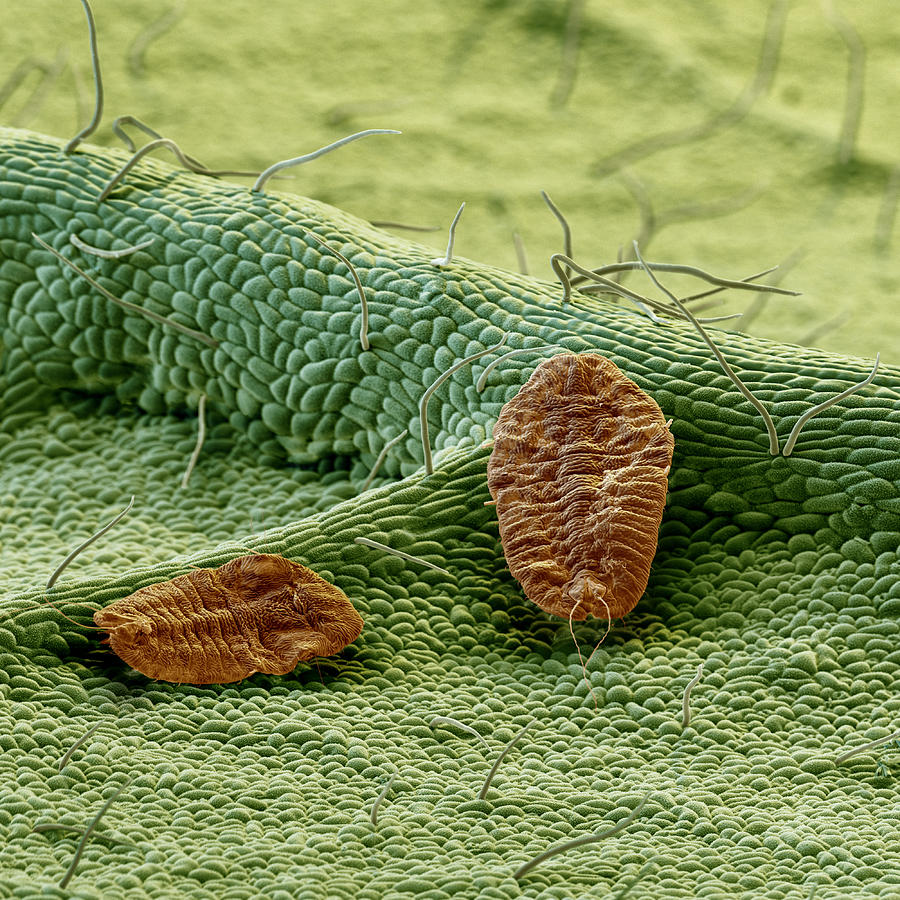 Scale Insects On An Avocado Sem Photograph by Meckes/ottawa