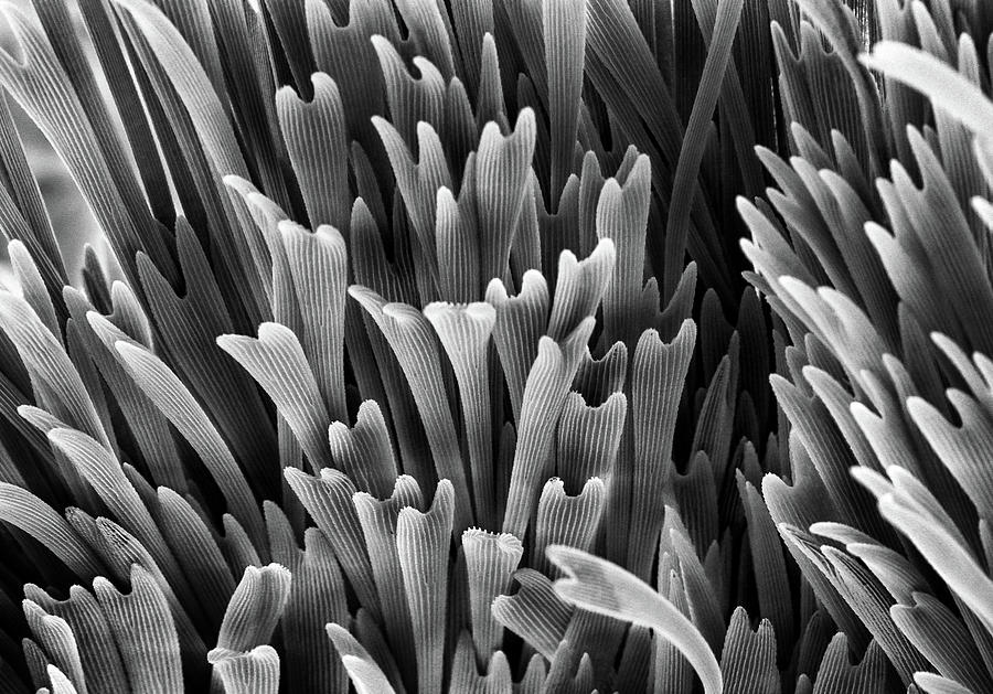Scales around genitalia by Beauty of Science Scales around genitalia by Beauty of Science