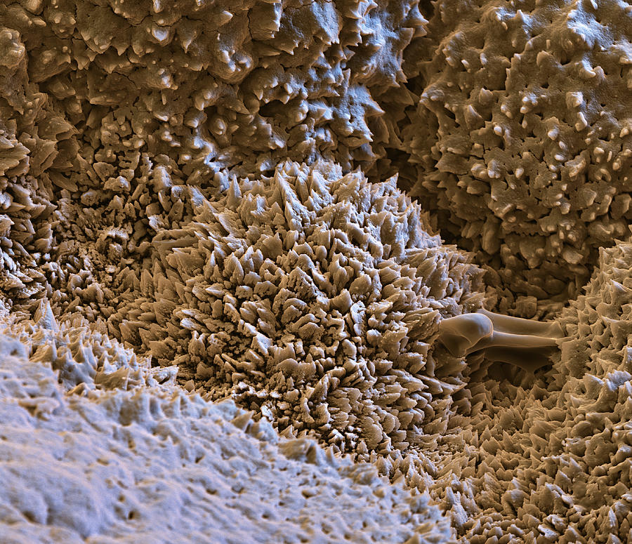 Seed Surface, Sem Photograph by Oliver Meckes EYE OF SCIENCE