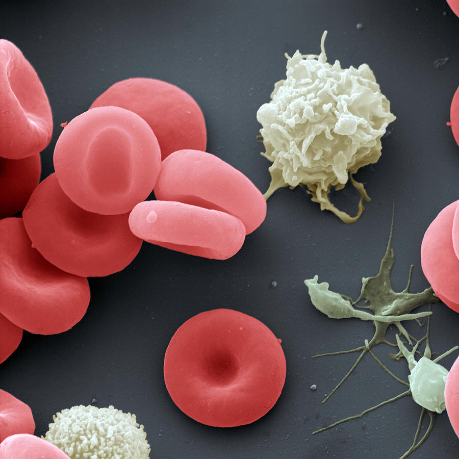 Sem Of Blood Cells Photograph by Meckes/ottawa