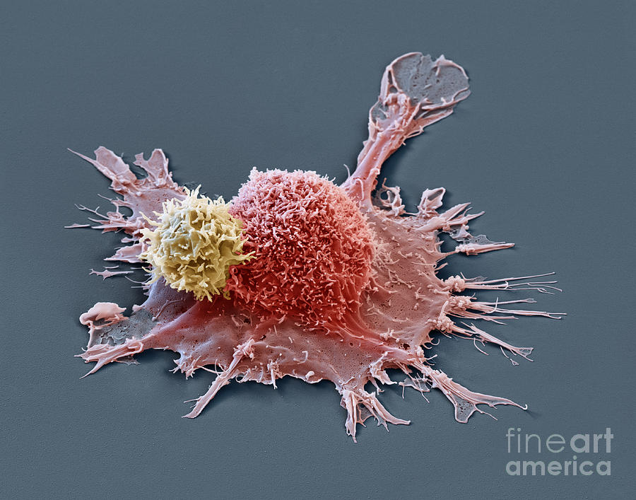 SEM of chimera antigen receptor cell Photograph by Eye of Sceince