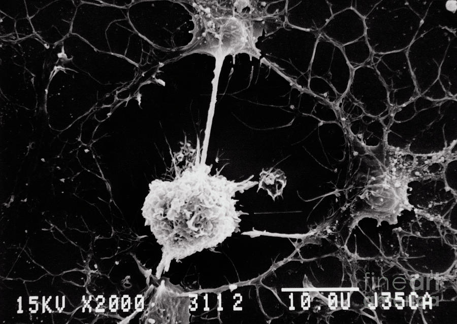 Sem Of Microglial Cell Attacking Oligodendrocytes Photograph by ...