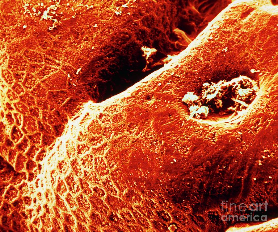 Gastric Photograph - Sem Of The Human Stomach Mucosa by Photo Insolite Realite/science Photo Library