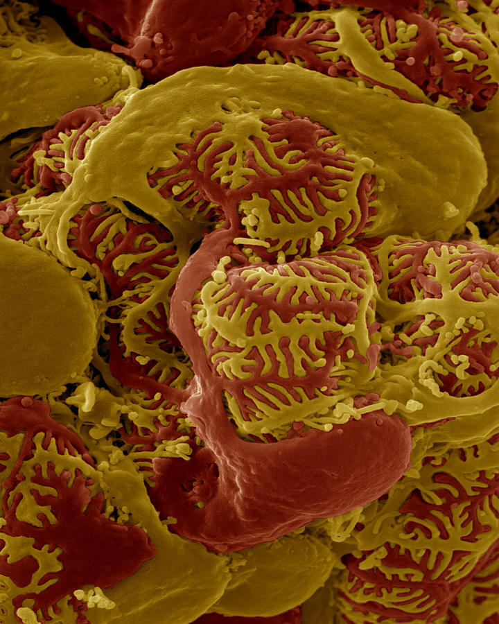 Sem Of The Kidney Photograph by Meckes/ottawa