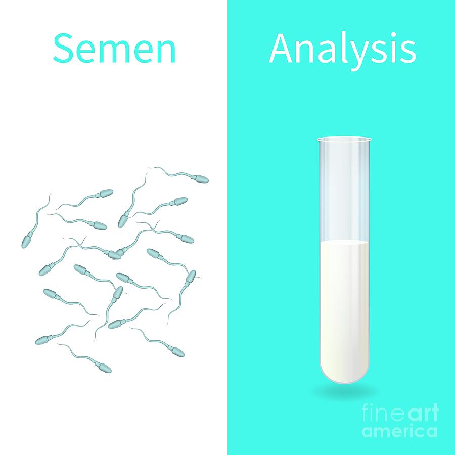 Sperm tube. Спермограмма пробирка. Сперматозоиды в пробирке. Semen Analysis. Мужское семя в пробирке.