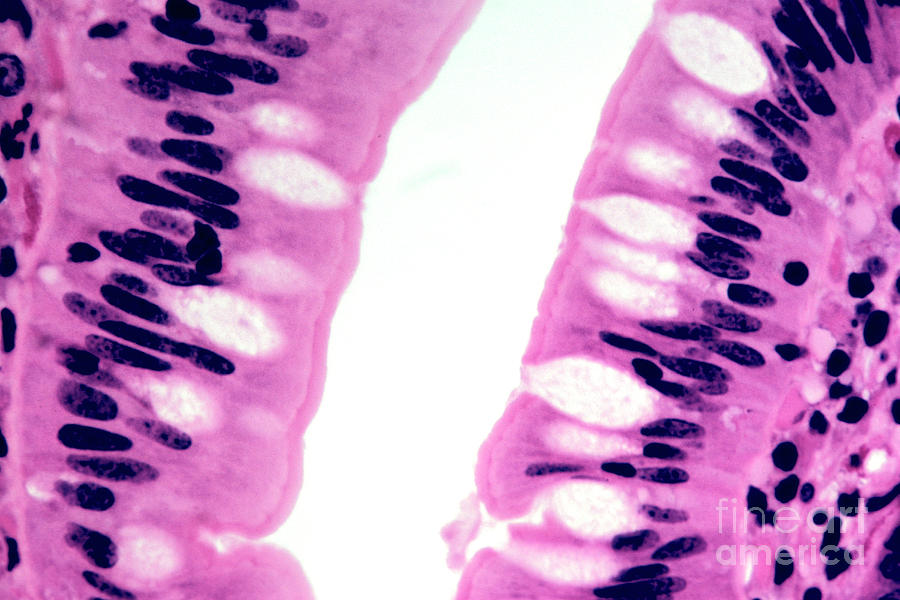 Simple Columnar Epithelium Photograph by Dr Richard Kessel / Science Photo Library