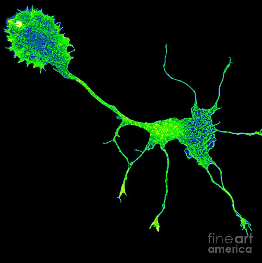 Single Brain Cell Showing Cytoskeleton Photograph by Howard Vindin, The University Of Sydney/science Photo Library