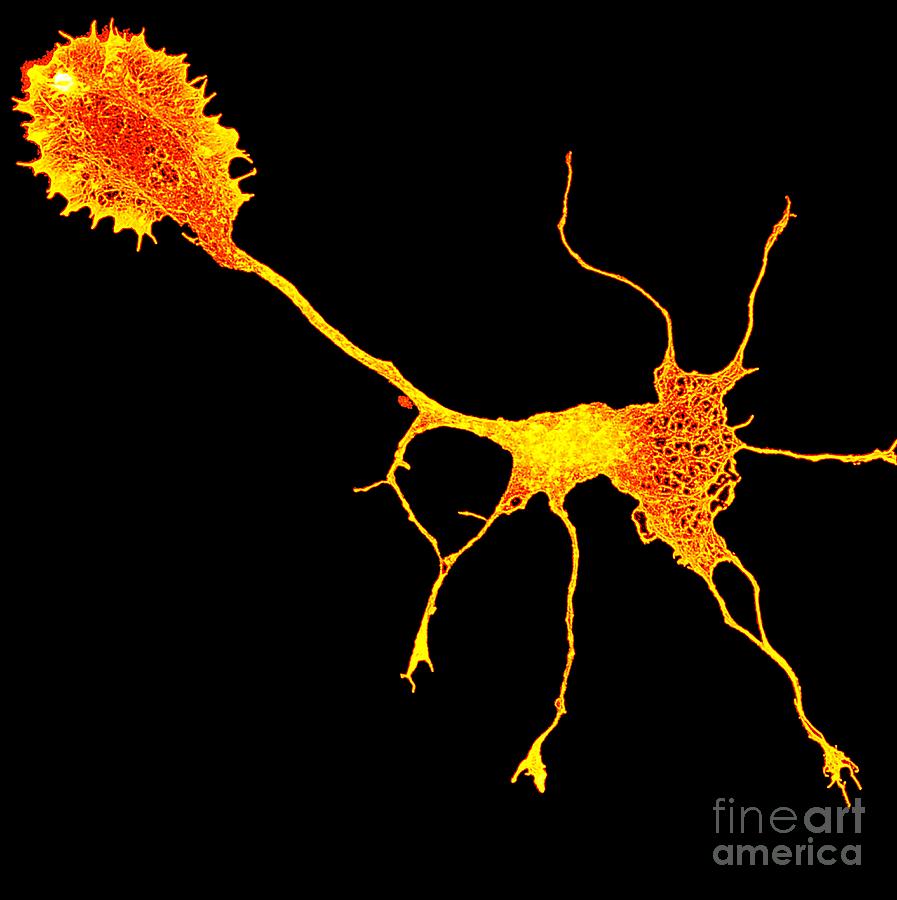 Single Cortical Neuron Photograph by Howard Vindin, The University Of Sydney/science Photo Library