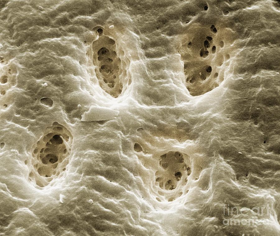 Skeletal Bone Showing Haversian Canals Photograph by Dr. Richard Kessel ...