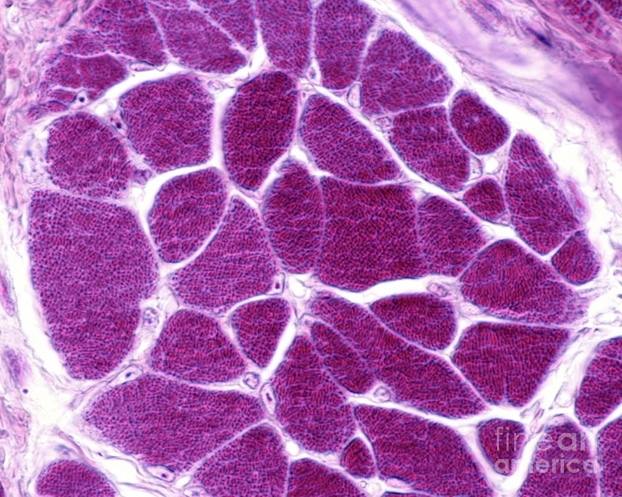 Biological Photograph - Skeletal Muscle Fibres by Jose Calvo/science Photo Library