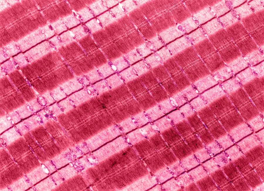 Cell Photograph - Skeletal Muscle, Longitudinal Section Lm by Don Fawcett