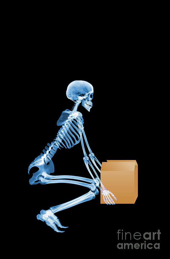 Skeleton Lifting A Box Correctly Photograph by D. Roberts/science Photo Library