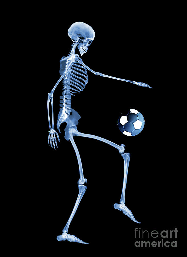 Skeleton Playing Football Photograph by D. Roberts/science Photo Library