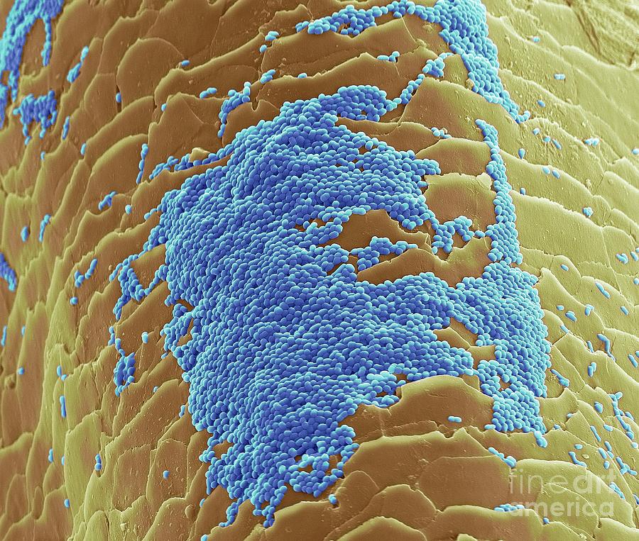 Skin Bacteria On Hair Photograph by Steve Gschmeissner/science Photo ...