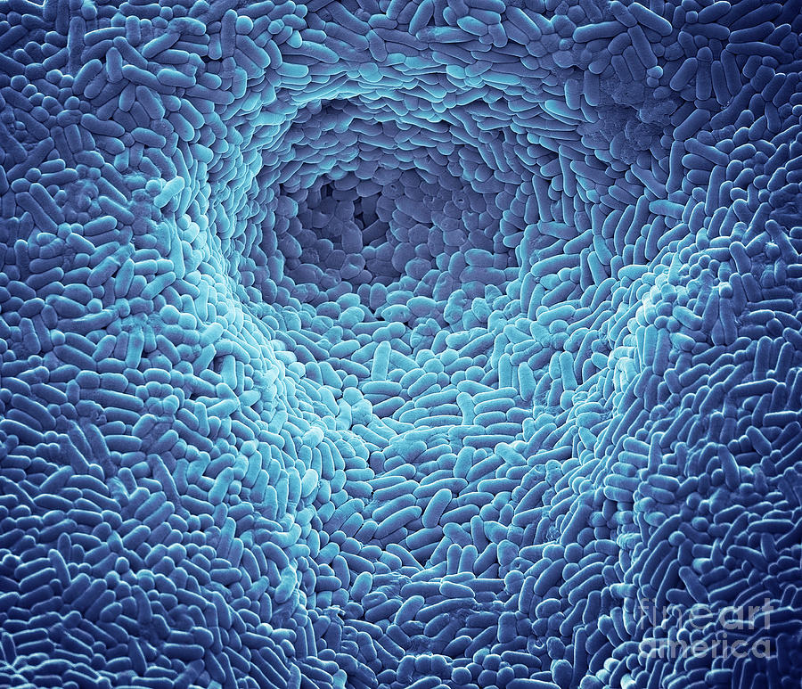 Skin Bacteria Photograph By Steve Gschmeissner Science Photo Library