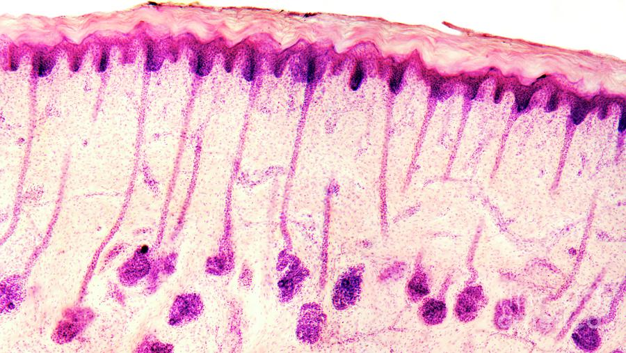 Human Photograph - Skin Sweat Glands by Dr Keith Wheeler/science Photo Library