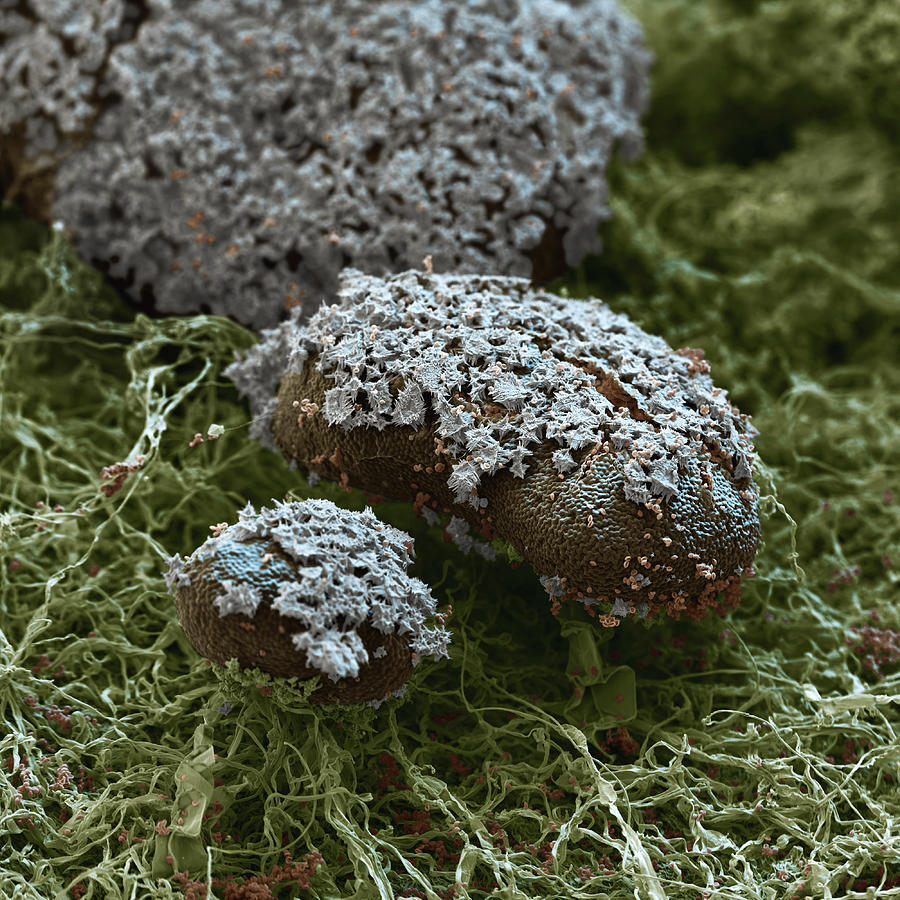 Slime Mold Fruiting Bodies Photograph by Meckes/ottawa