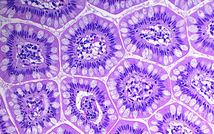 Small Intestine Cells Photograph by Ziad M. El-zaatari/science Photo Library