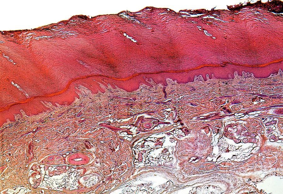 Skin Photograph - Sole Of The Foot by Dr Keith Wheeler/science Photo Library