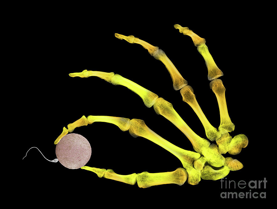 Skeleton Photograph - Sperm Fertilising Egg Held By A Skeleton by D. Roberts/science Photo Library