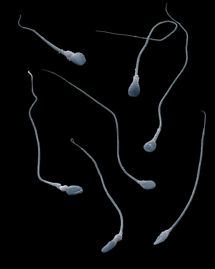 Sperm Photograph by Oliver Meckes EYE OF SCIENCE