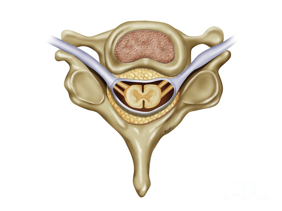 Spinal Vertebra Anatomy Photograph by Maurizio De Angelis/science Photo ...