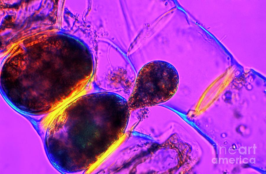 Spirogyra Algae Photograph by Dr Keith Wheeler/science Photo Library
