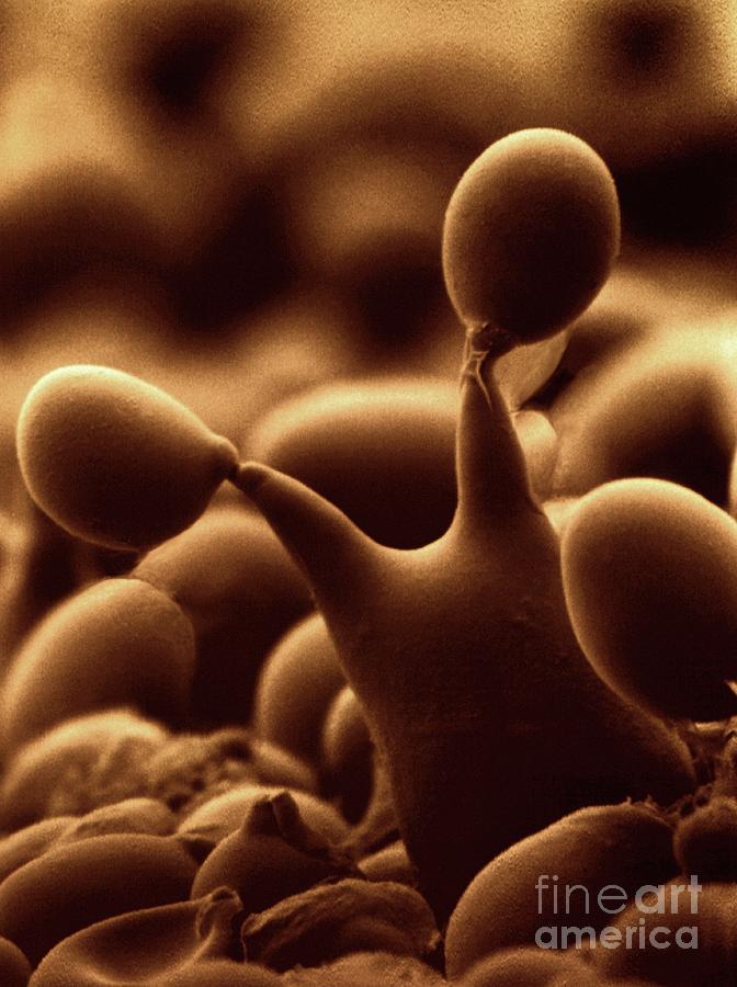 Mushroom Photograph - Spores On Basidium Of Agaricus Bisporus by Steve Lowry/science Photo Library