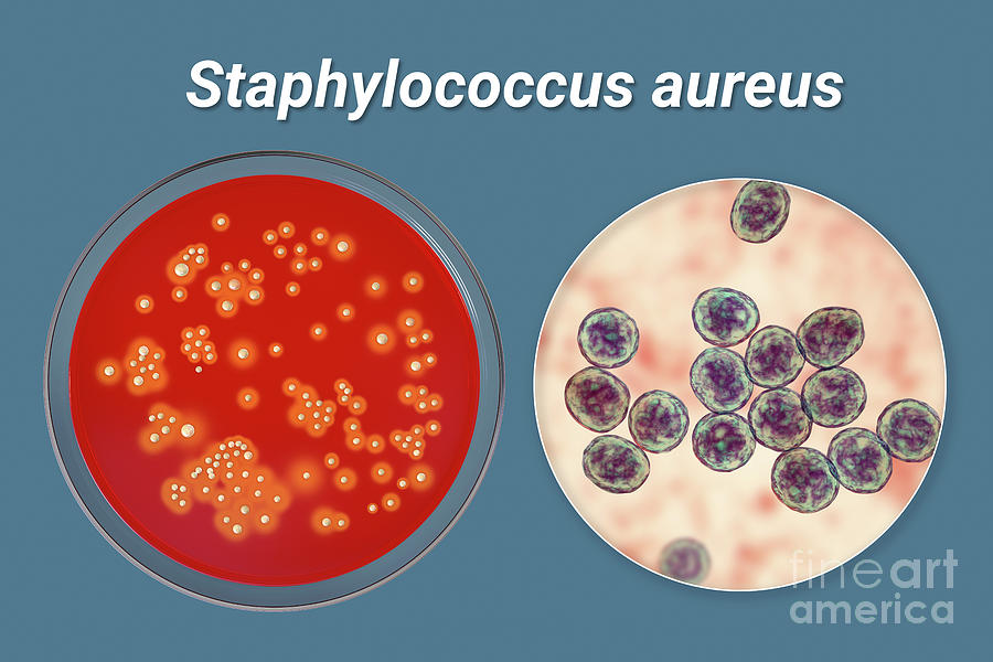 Staphylococcus Aureus Bacteria Photograph By Kateryna Kon Science Photo