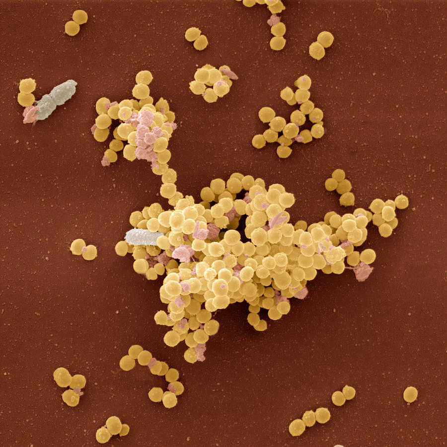 Staphylococcus Aureus Bacteria Photograph by Meckes/ottawa