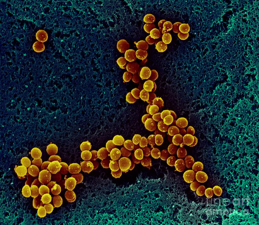 Staphylococcus Aureus Bacteria Photograph By Steve Lowry Science Photo