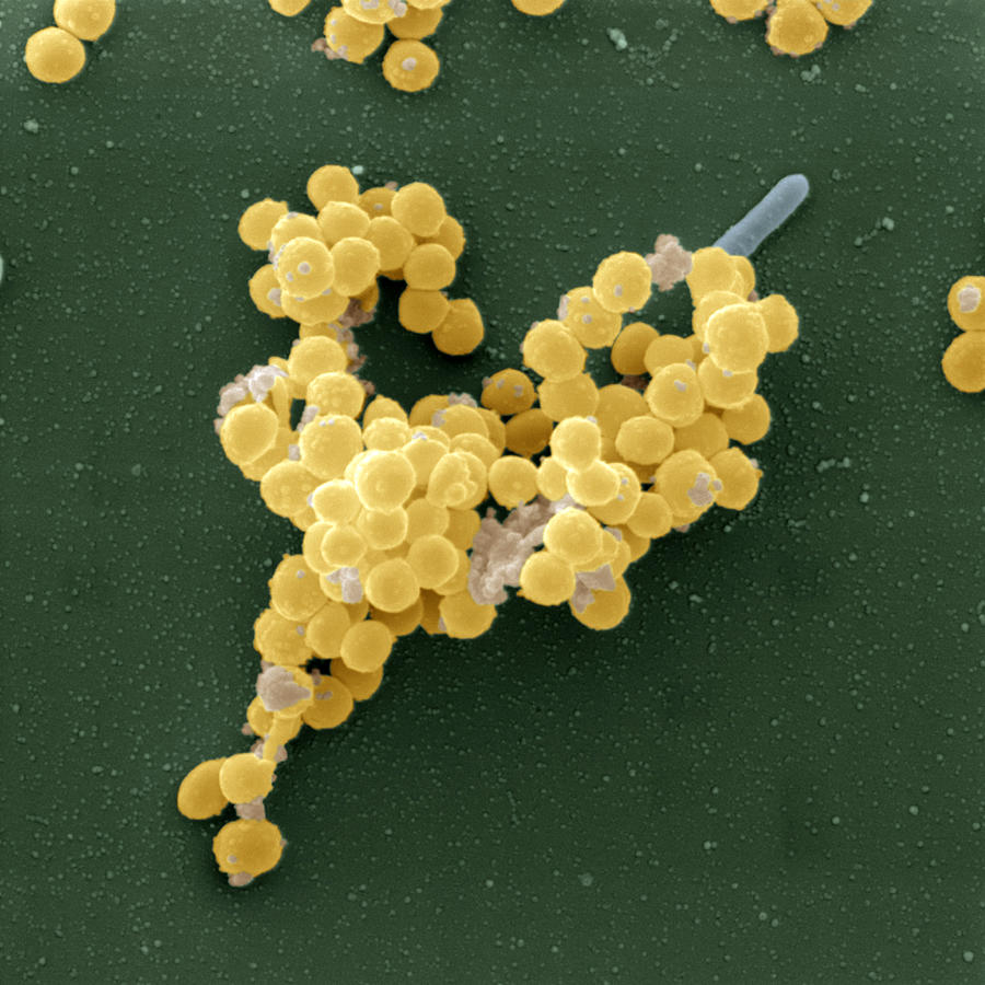 Staphylococcus Aureus Photograph by Meckes/ottawa