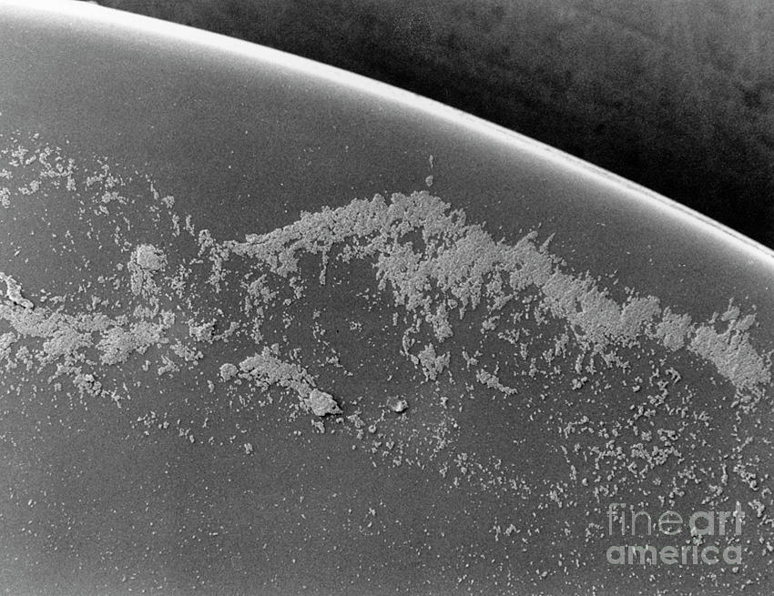 Staphylococcus Bacteria On Eye Lens Photograph By Dr Kari Lounatmaa