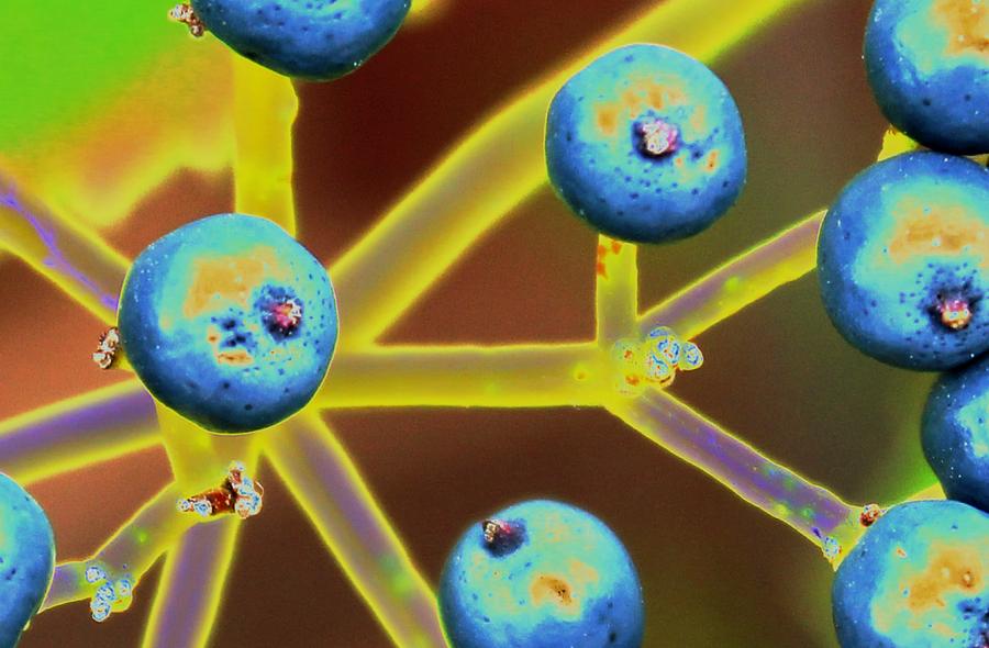 Stems and Orbs in Neon Yellow by AJP Stems and Orbs in Neon Yellow by AJP